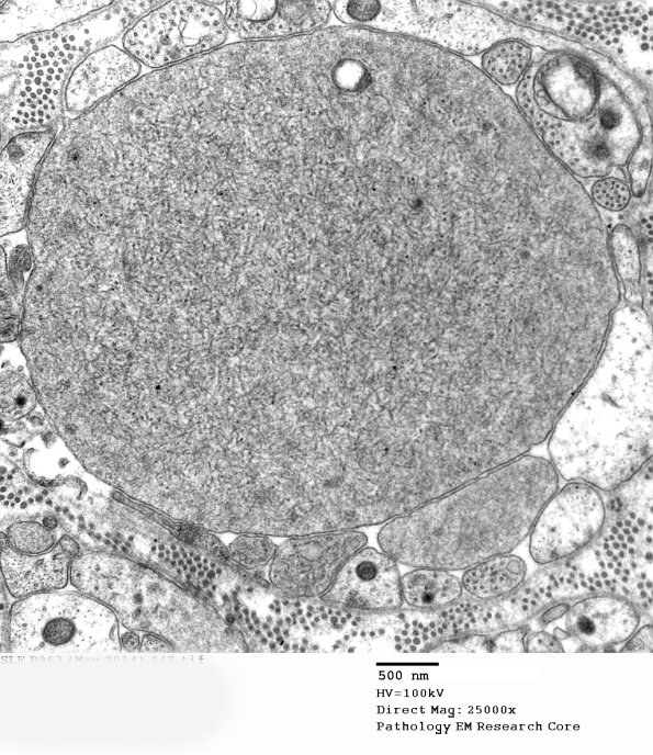 3B13B SLE (Case 1)_047 - Copy