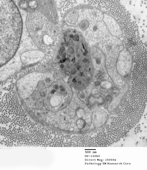 3B14 SLE Case 1 (May 2014)_063 - Copy