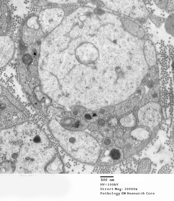 3B15A SLE Case 1)_067 - Copy