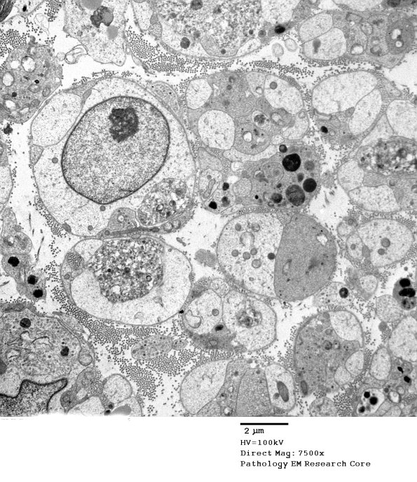 3B2A SLE Case 1)_013 - Copy