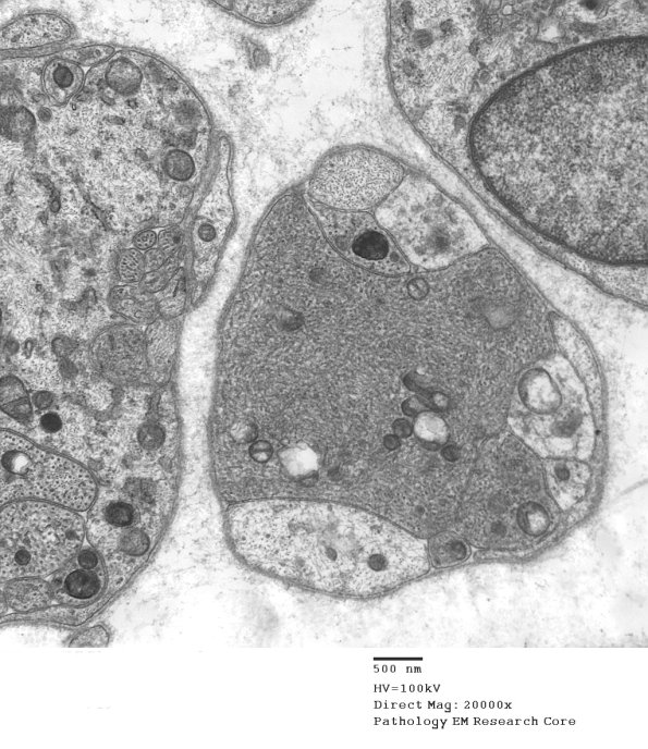 3B5 AR SLE EM025 - Copy