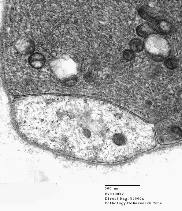 3B5A AR (Case 1) SLE EM026 - Copy