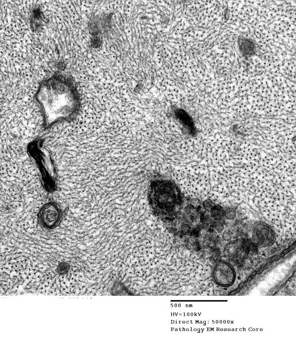 3B9A (Case 1) SLE EM038 - Copy