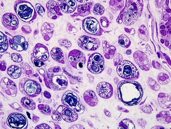 4A1 AD-Regen (Case 3) Plastic 19.jpg