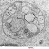4B7 Axonal Regeneration (Case 3) EM 019 - Copy