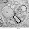 4B8 Axonal Regeneration (Case 3) EM 039 - Copy