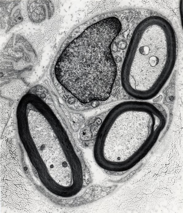 7B Regeneration, axon cluster EM 1 - Copy