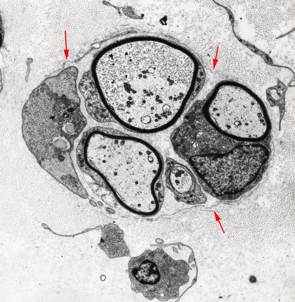 7D1 (Rat regenerative cluster)
