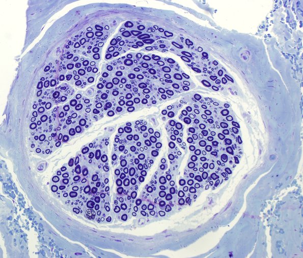 8A Axon thin for Caliber (Case 12) Plastic 4.jpg