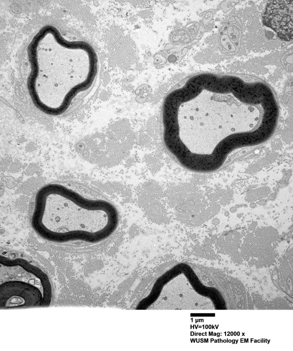 9B1 W25-1606 Bridgers A (Case 16) Sural_025 - Copy