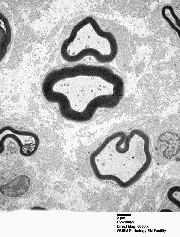 9B2 W25-1606 Bridgers A (Case 16) Sural_022 - Copy