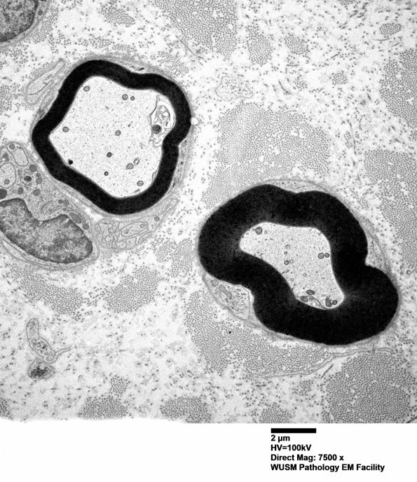 9B3 W25-1606 Bridgers A (Case 16) Sural_013 - Copy