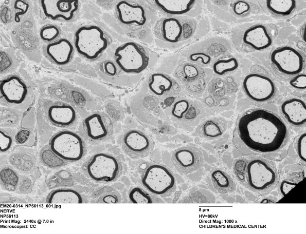 9C1 EM20-Case 17 Hunter Cai - Copy