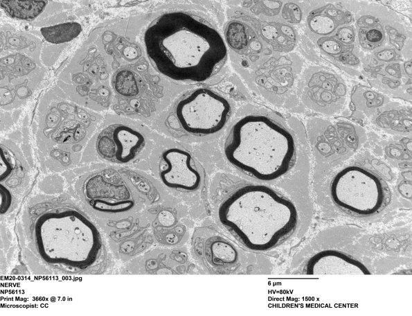 9C2 EM20-Case 17 003 - Copy