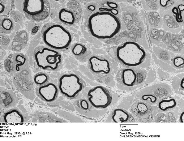 9C3 EM20-Case 17_015 - Copy