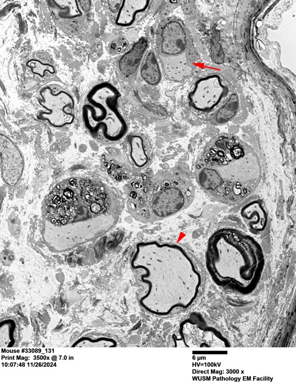 2A1 Mouse #33089 (Case 2) 131AA copy.jpg