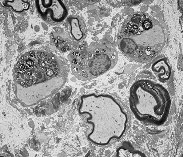 2A2 Mouse #33089 (Case 2) 064.jpg