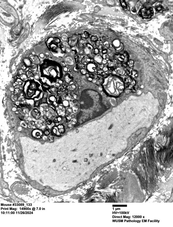 2A3 Mouse #33089 (Case 2) 133AA.jpg