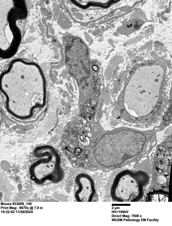 2A4 Mouse #33089 (Case 2) 140a.jpg