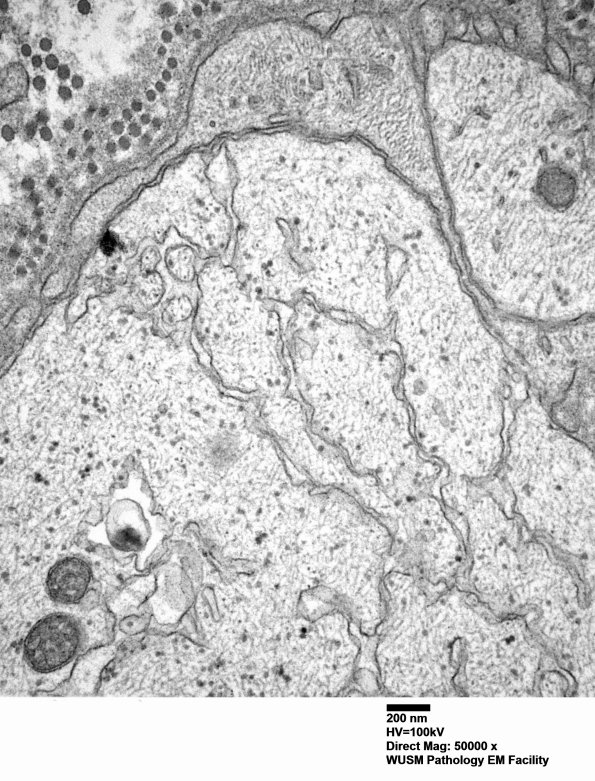 5B5 (Case 5) EM 008 - Copy