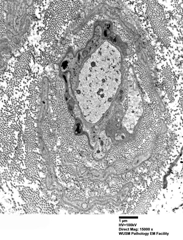 5B7 (Case 5) EM 021 - Copy