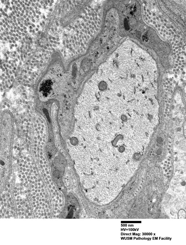 5B8 (Case 5) EM 022 - Copy