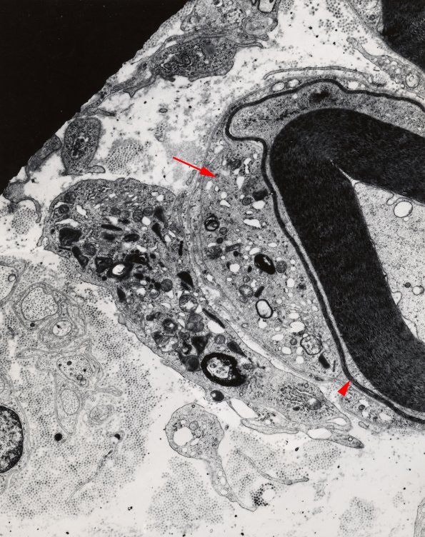 1D1a GBS, (Case 1) EM 1 SMALL