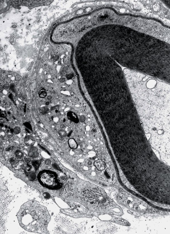 1D2 GBS, (Case 1) EM 3 - Copy