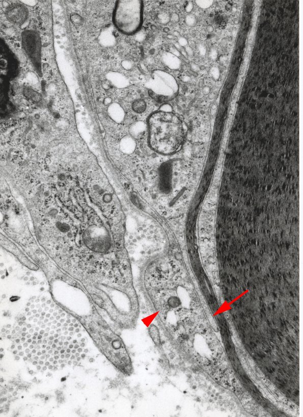 1D3 GBS, (Case 1) EM 5 copy - Copy