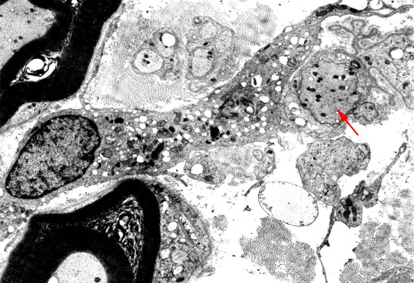 1D6 GBS, (Case 1) EM 1 copy - Copy
