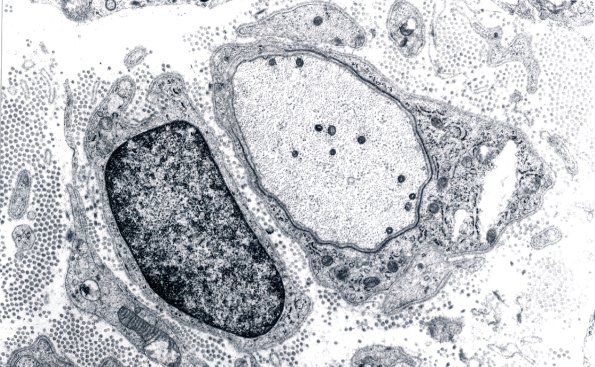 1D7 GBS, (Case 1) EM 8 - Copy