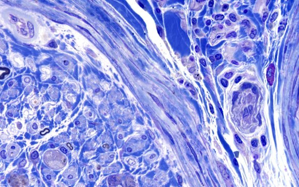 2E2 GBS (Case 2) Plastic 100X 2