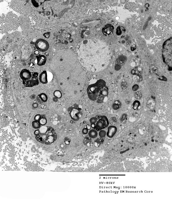 2F1A GBS (Case 2) M 072 - Copy