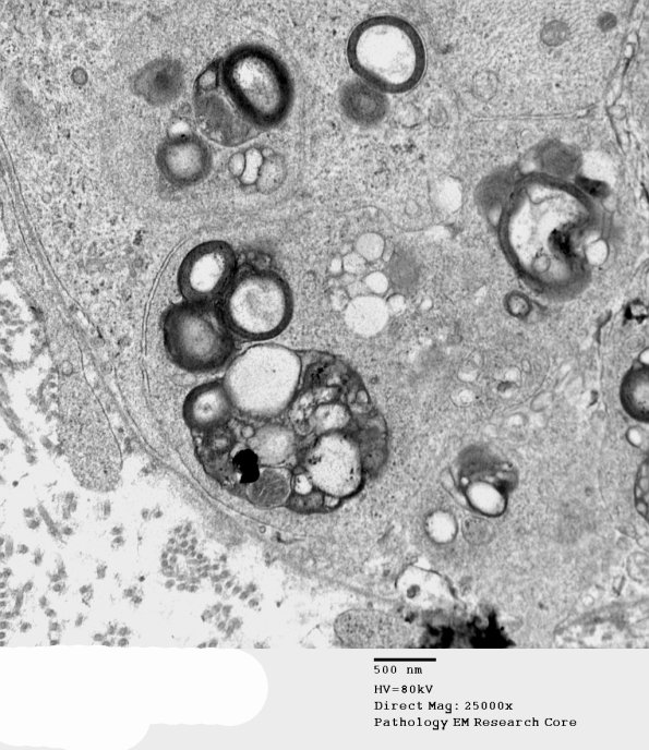 2F1B GBS (Case 2) EM 073 - Copy