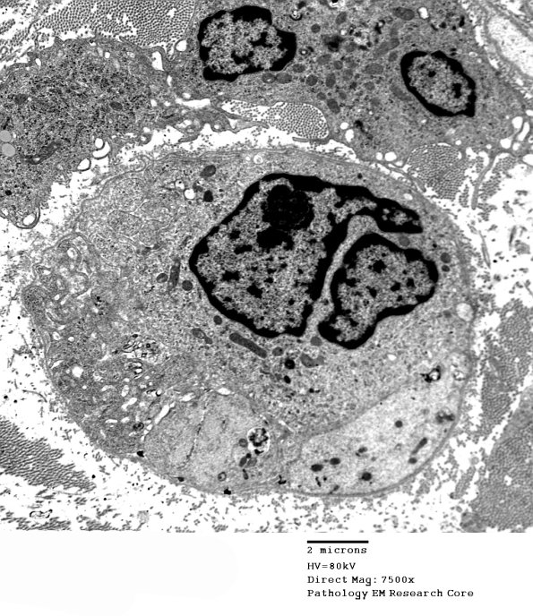 2F2A (Case 2) EM 007 - Copy