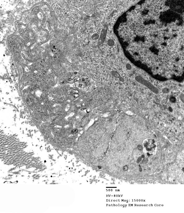 2F2B GBS (Case 2) EM 008 - Copy