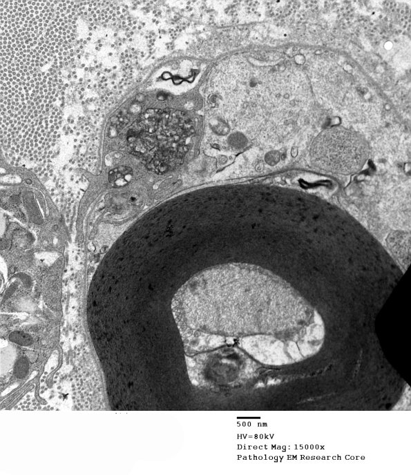 2F3A GBS (Case 2) EM 019 - Copy