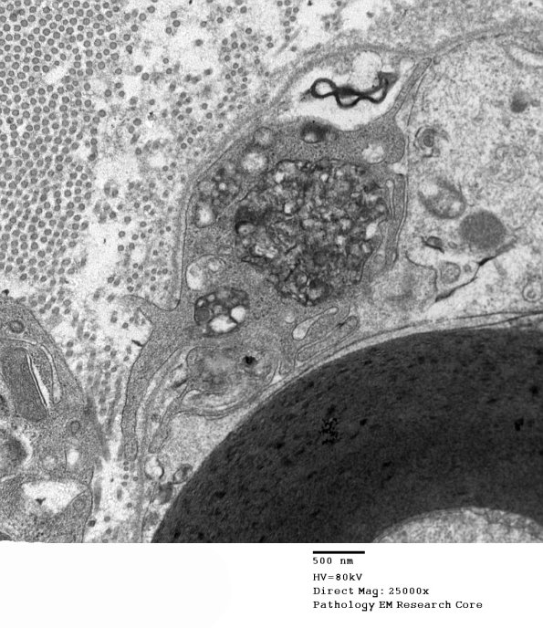 2F3B GBS (Case 2) EM 020 - Copy
