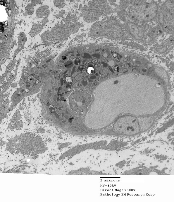 2F4A GBS (Case 2) EM 013 - Copy