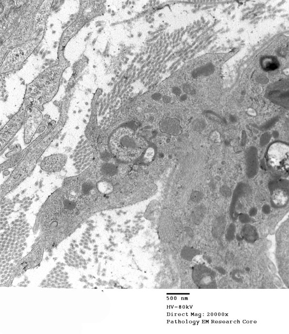2F4B GBS (Case 2) EM 014 - Copy