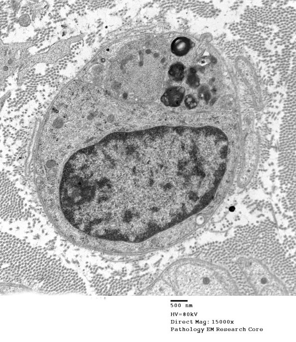 2F5A Case 2 074 - Copy