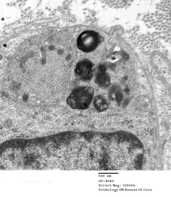 2F5B Case 2 Nerve_075 - Copy