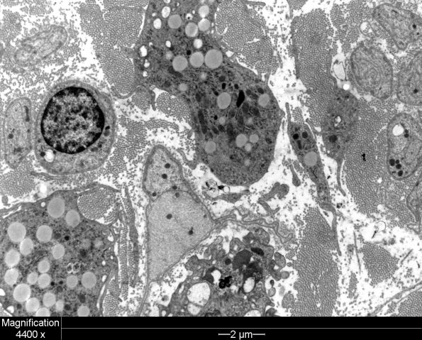 2F6 Case 2 Grid2_006 - Copy