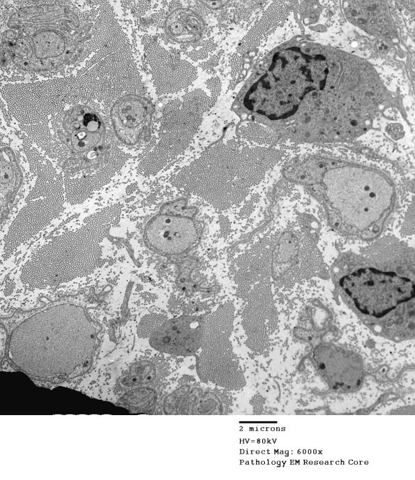 2F7A GBS (Case 2) EM 037 - Copy