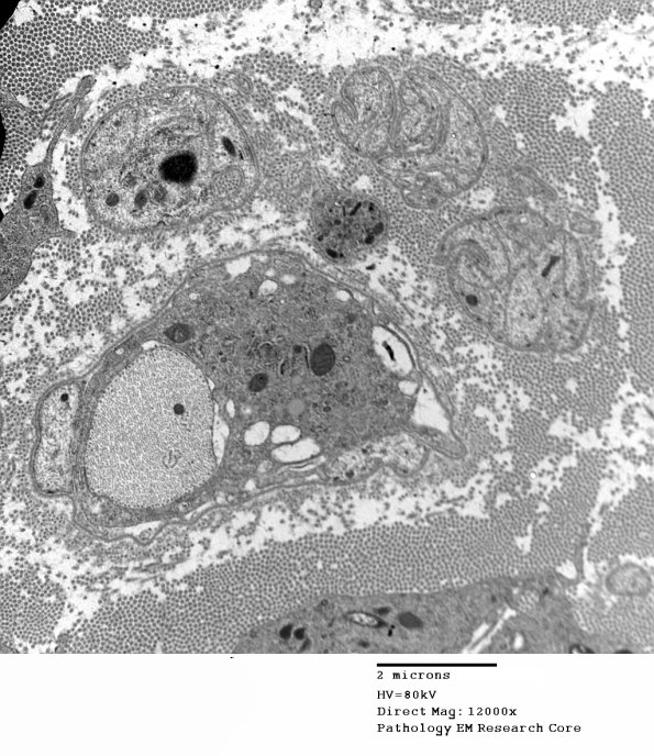 2F7B GBS (Case 2) EM 005 - Copy
