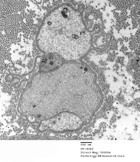 2F7C GBS (Case 2) EM 023 - Copy