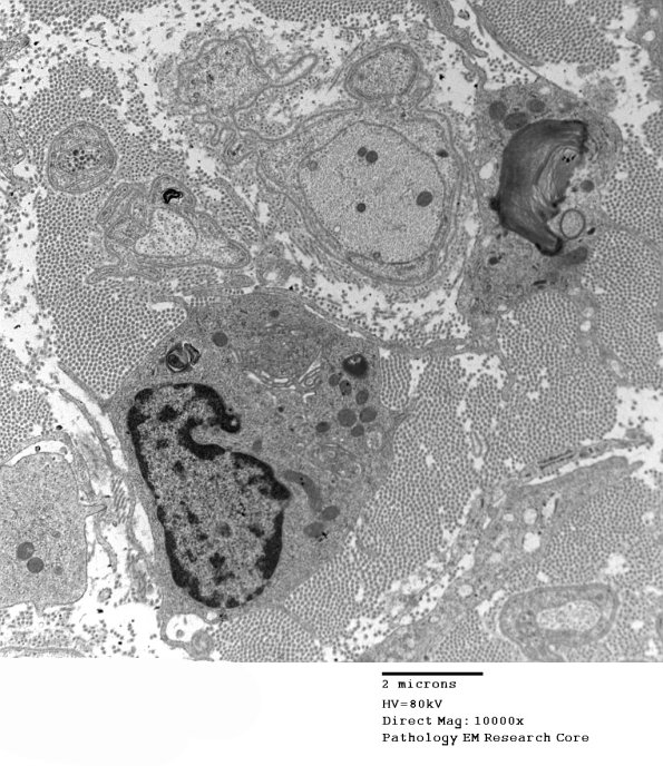 2F7D GBS (Case 2) EM 024 - Copy