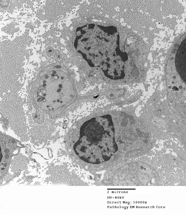 2F7E Case 2 Nerve_025 - Copy
