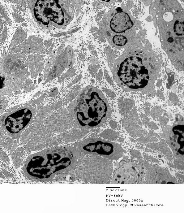 2F8A GBS (Case 2) EM 082 - Copy