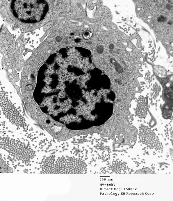 2F8B GBS (Case 2) EM 083 - Copy